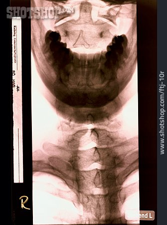 
                Röntgenbild, Halswirbelsäule                   