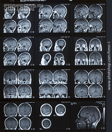 
                Gehirn, Mrt, Tomographie                   