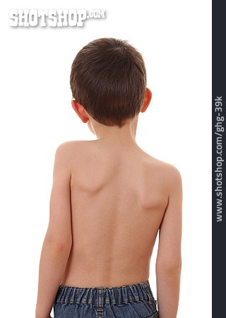 
                Junge, Schmerzen, Schief, Rücken, Wirbelsäule, Orthopädie, Schulterblatt                   