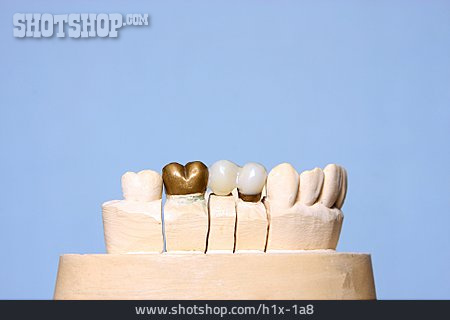 
                Zahnersatz                   