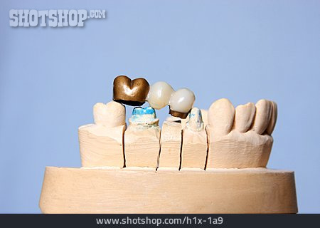 
                Zahnersatz                   