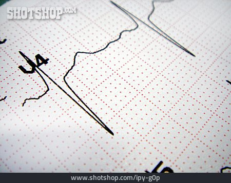 
                Elektrokardiogramm, Testkurve                   