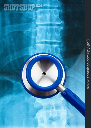 
                Stethoskop, Wirbelsäule, Röntgenaufnahme                   