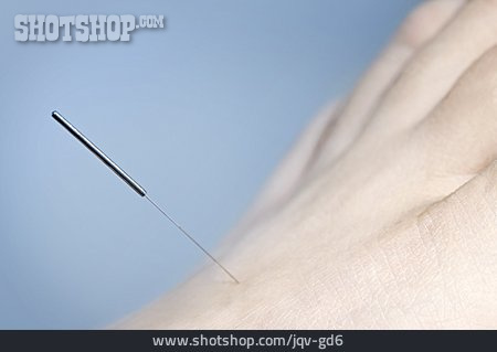 
                Nadel, Behandlung, Akupunktur                   