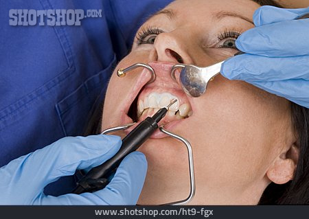
                Patientin, Zahnarztbehandlung, Bleaching                   