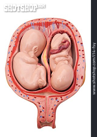 
                Zwillinge, Gebärmutter, Anatomiemodell, Fötus                   