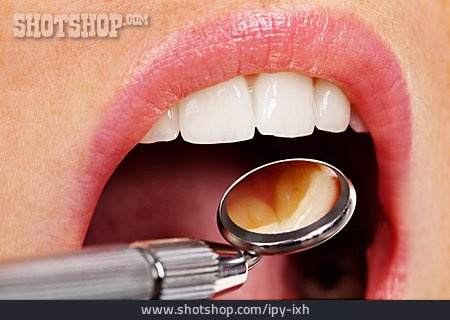 
                Zahnbehandlung, Zahnarzt, Zahnarztbesuch, Mundspiegel                   