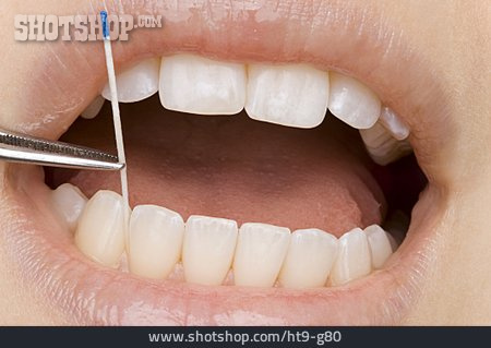 
                Zahnbehandlung, Zahnarztbesuch, Zahnarztbesteck                   