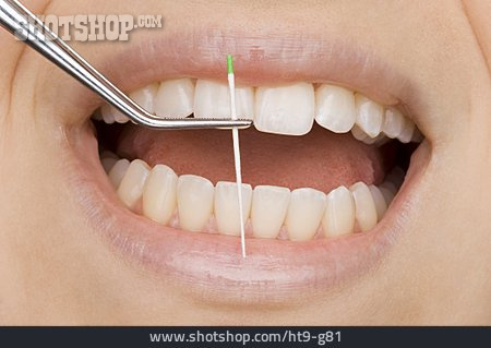
                Zahnbehandlung, Zahnarztbesuch, Zahnarztbesteck                   