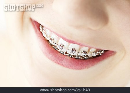 
                Zähne, Zahnmedizin, Zahnspange                   