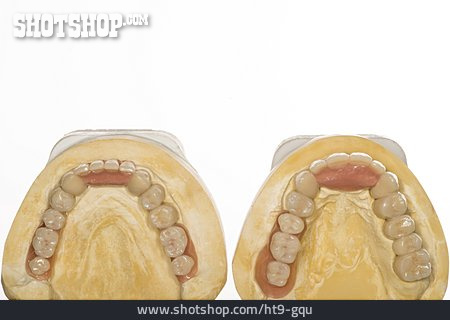 
                Gebiss, Zahnersatz, Zahnmodell                   