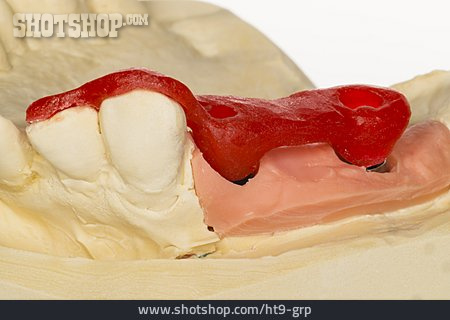 
                Zahnersatz, Zahnfleisch, Zahnfleischmaske                   