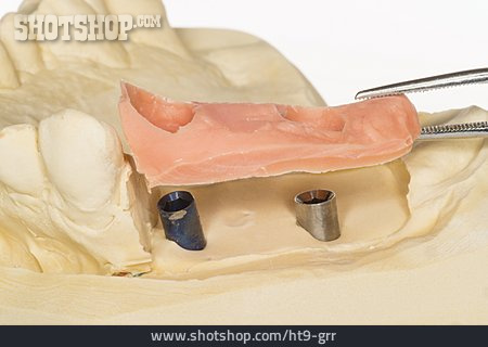 
                Zahnersatz, Zahnfleisch, Zahnfleischmaske                   