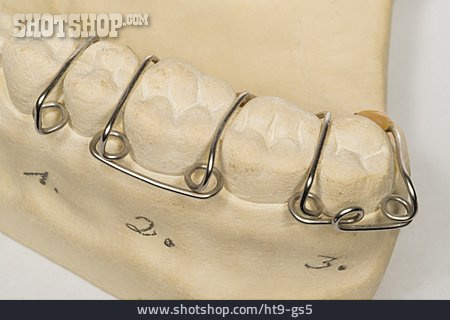 
                Kieferorthopädie, Zahnkorrektur, Zahnfehlstellung                   