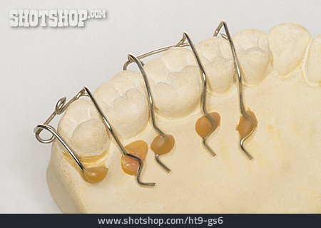 
                Kieferorthopädie, Zahnkorrektur, Zahnfehlstellung                   