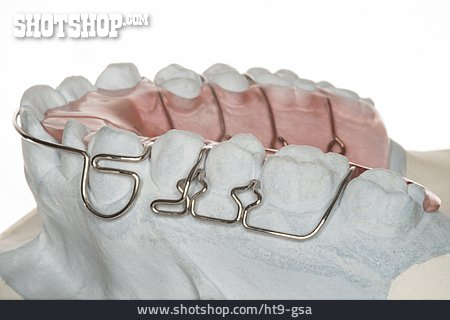 
                Zahnspange, Zahnkorrektur                   