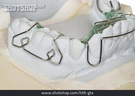 
                Zahnspange, Zahnkorrektur                   