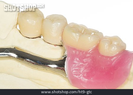 
                Zahnersatz, Zahnprothese, Zahnimplantat, Zahnkrone                   