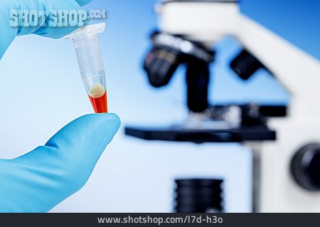 
                Forschung, Labor, Blutprobe, Eppendorf-röhrchen                   