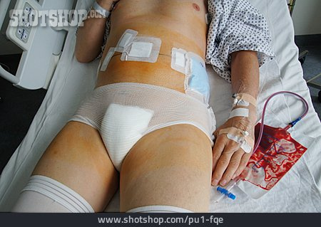 
                Accident, Surgery, Abdominal Surgery                   