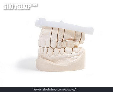 
                Zahnmodell, Zahnprothese                   