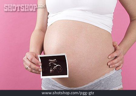 
                Ultraschallbild, Schwangerschaft                   