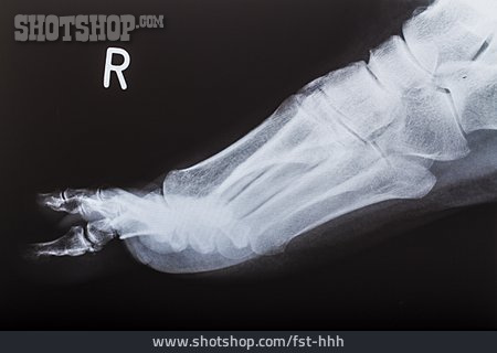 
                Röntgenbild, Fußgelenk                   