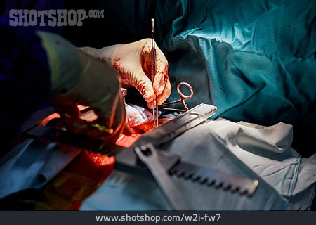 
                Chirurg, Operation, Herzoperation                   