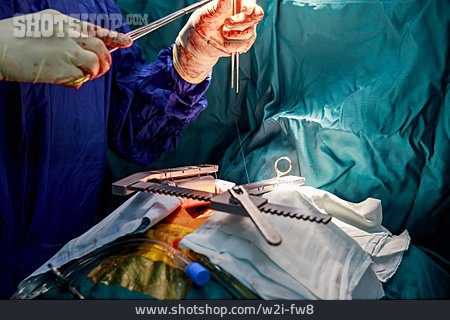 
                Chirurg, Operation, Operieren, Herzoperation                   