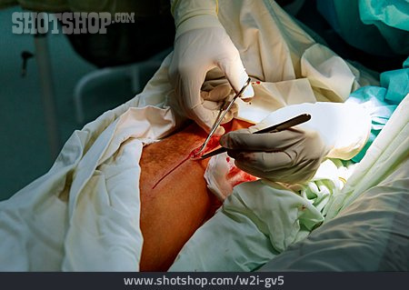 
                Chirurg, Operation, Operieren                   