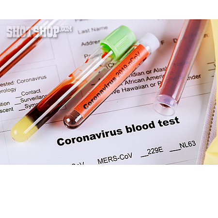 
                Laboruntersuchung, Bluttest, Coronavirus                   