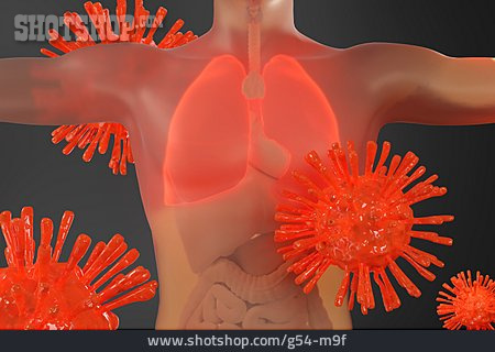 
                Virusinfektion, Lungenkrankheit, Covid-19                   