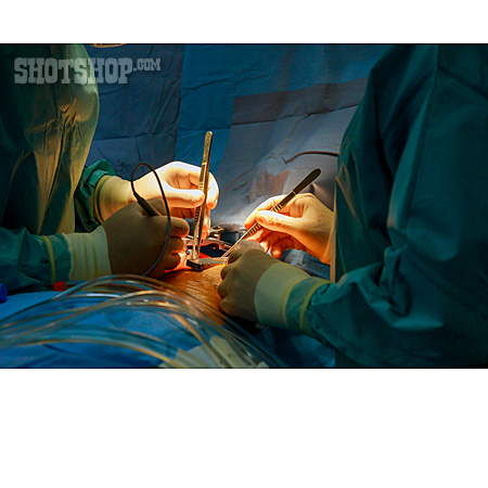
                Medizintechnik, Operation, Operationsbesteck                   