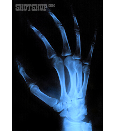 
                Hand, Röntgenbild                   