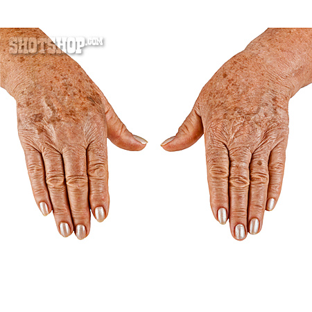 
                Hände, Haut, Altersflecken                   