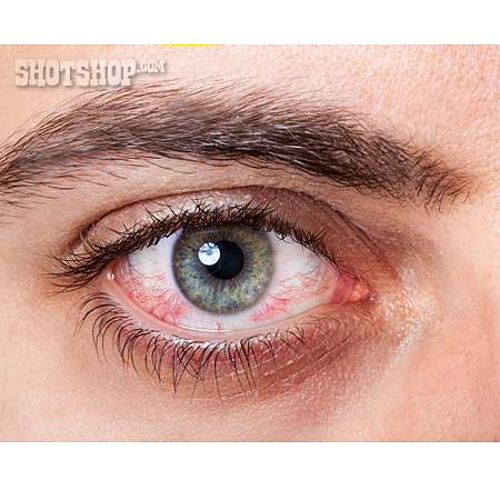 
                Augenheilkunde, Bindehautentzündung                   