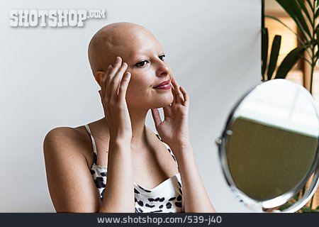 
                Erkrankung, Haarausfall, Alopecia Universalis, Keine Haare                   