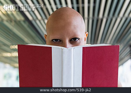 
                Glatze, Erkrankung, Haarausfall, Alopecia Universalis                   