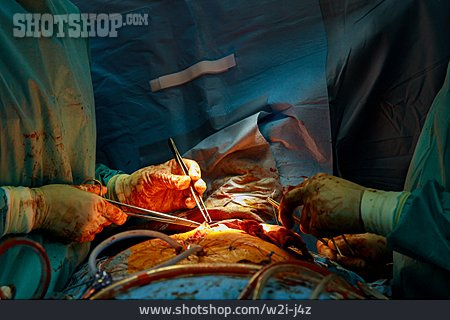 
                Operation, Kardiologie, Chirurgie, Operieren                   