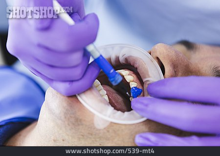 
                Zähne, Gebiss, Patient, Gel, Zahnarztpraxis, Auftragen                   