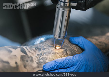 
                Tattoo, Entfernen, Lasergerät, Tattoostudio                   