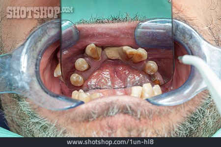 
                Zähne, Gebiss, Parodontitis                   